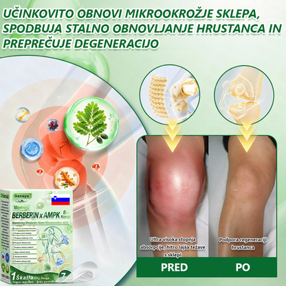 𝐆𝐞𝐧𝐚𝐲𝐮® 𝒎𝒆𝒕𝒂𝒃𝒐𝒍𝒊𝒄𝒌á 𝒏𝒂𝒏𝒐 𝒎𝒊𝒌𝒓𝒐𝒕ű𝒔 𝒕𝒂𝒑𝒂𝒔𝒛🎉 (Používá se pouze jednou denně, viditelné výsledky již do 7 dnů!) ✅ Formulace s berberinem a moringou, ideální pro podporu kontroly tělesné hmotnosti, metabolismu a celkové vitality 💥💥